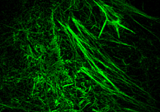 SIM結(jié)構(gòu)光成像