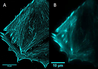 一種光熱療法抑制癌細胞轉移的研究